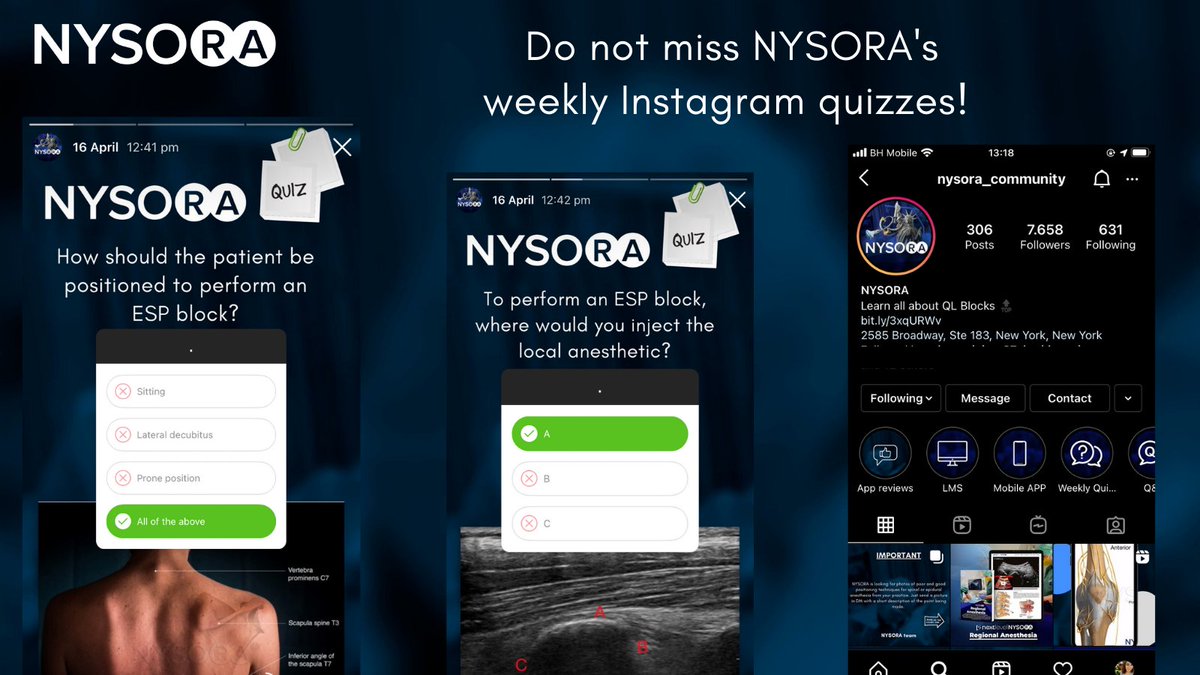 NYSORA’s weekly quizzes have become a favorite among our readership, with a consistent rise in engagement. Follow us on Instagram bit.ly/NYSORAInstagram to take part in the fun and informative weekly quizzes and receive updates on NYSORA’s educational material.

#NYSORA #nerve