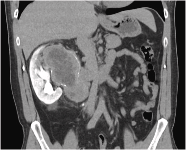 Urology Case Reports tweet media