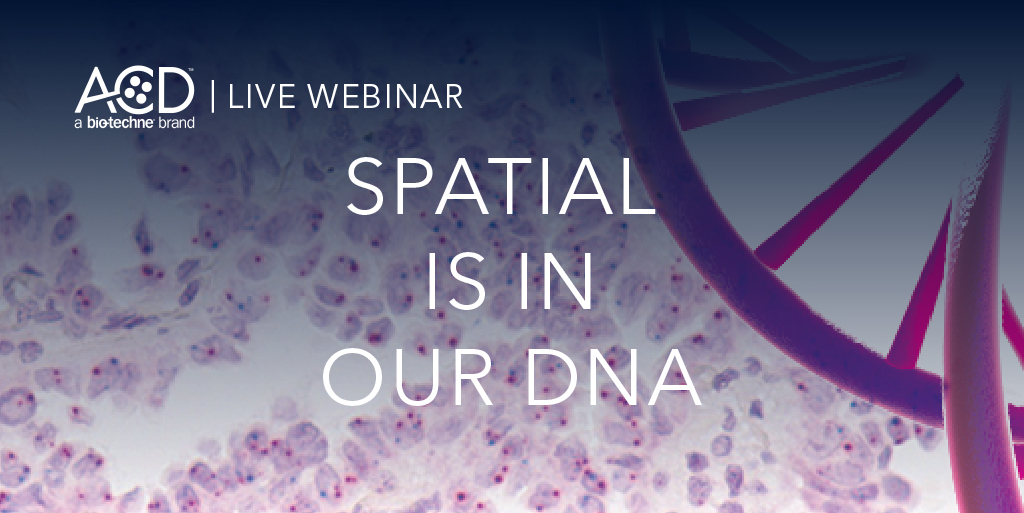 bt_spatial's tweet photo. Happy DNA DAY! What could be better than celebrating this auspicious day that learning about our new DNAscope Assay? #SPATIALisinourDNA #AdvancingOurRNAISH #DNAday2021
April 27, 2021 at 10am PST | 1pm EST Register: https://t.co/Q9BBgNoAA4 https://t.co/P3PVpcbuYT