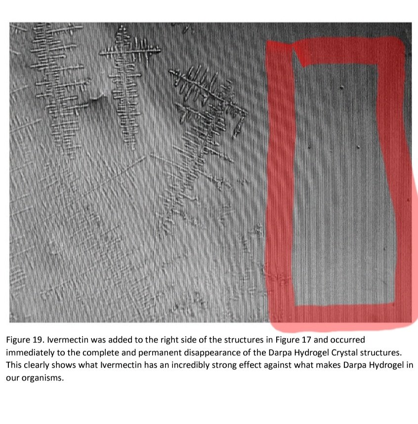 À ce stade, pour ceux qui ont été testés, vous avez encore une chance d'y échapper tant que vous ne prenez pas le ! Ça explique d'ailleurs pourquoi l'ivermectine et autres traitements sont interdits!Les anticorps naturels et/ou les traitements détruisent ces structures