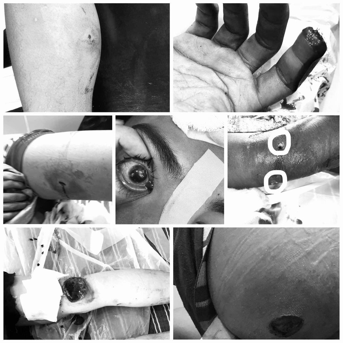 Zawmyoth's tweet photo. Tw // sensitive content How can a country’s military dare to hurt their own civilians? These are photo evidences of injured civilians who were shot and tortured by military junta. #WhatsHappeningInMyanmar #Apr25Coup #ASEANsupportNUG https://t.co/CfQYTcmXnX