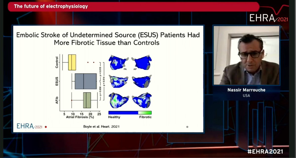 Dominik_Linz's tweet photo. @nmarrouche on rhythm control in persistent #AFib
--> #AFib burden (wearables/ILRs) and atrial cardiomyopathy (imaging) -> new classification?
Important for rhythm outcome and stroke risk.
--> #DECAAF II trial will come.
#EHRA2021 https://t.co/PtbcO3ERNV