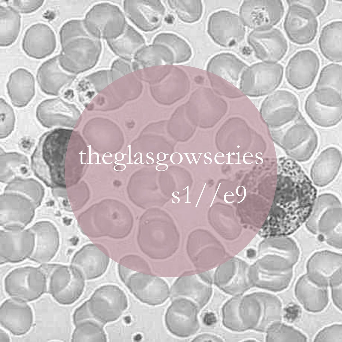 Today's episode features Professor Anthony Chalmers, consultant clinical oncologist. He presents an incredible story of success for a lady affected by brain cancer and explores the fundamental role of clinical trials in oncology @ProfAJChalmers @CRUK_BI <a href="/Beatson_Charity/">Beatson Cancer Charity</a>