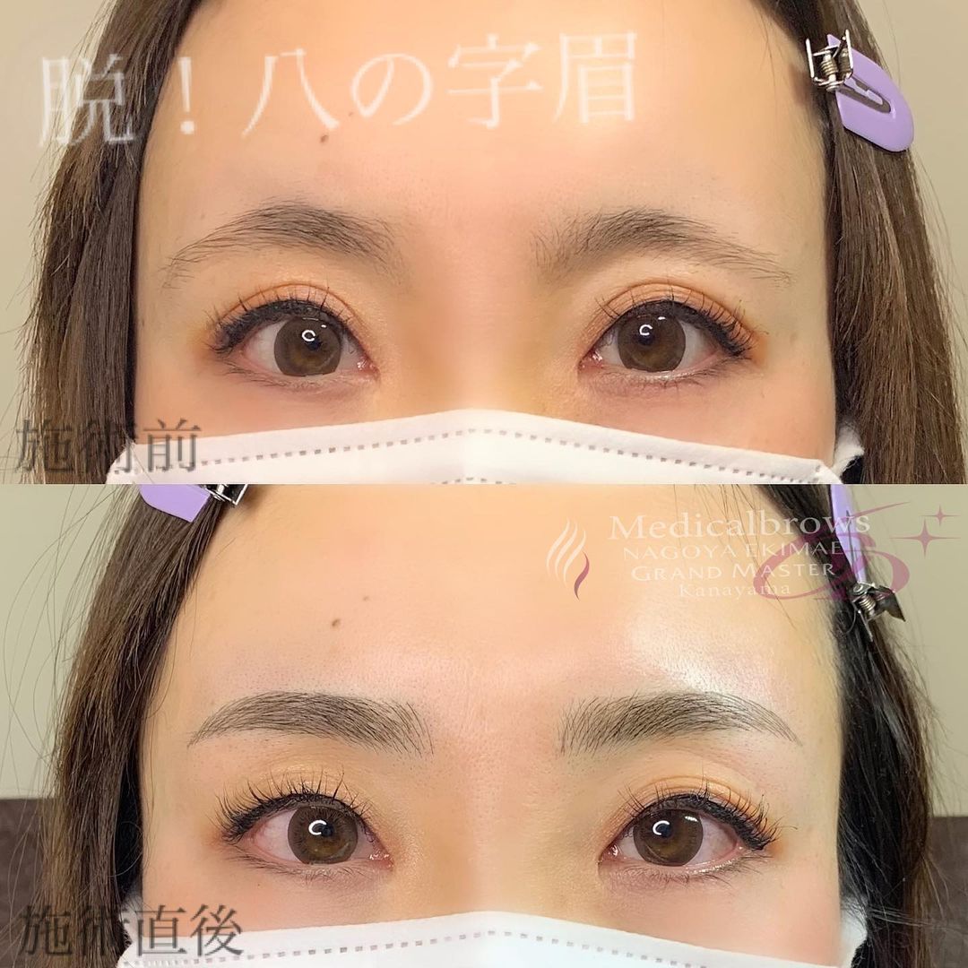 最新の眉アートメイク 6dストローク とは 感動レベルの仕上がり 東京美容クリニックマップ