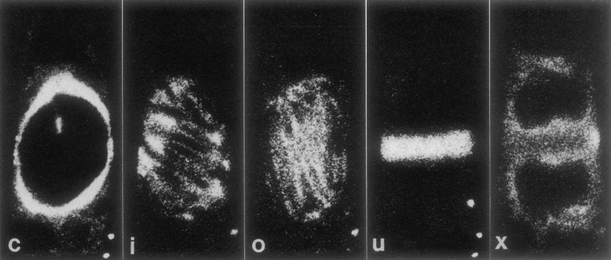 The newly invented confocal microscope was used in 1990 to image microinjected fluorescently-labeled pig tubulin in the plant's microtubule network during cell division. [2]