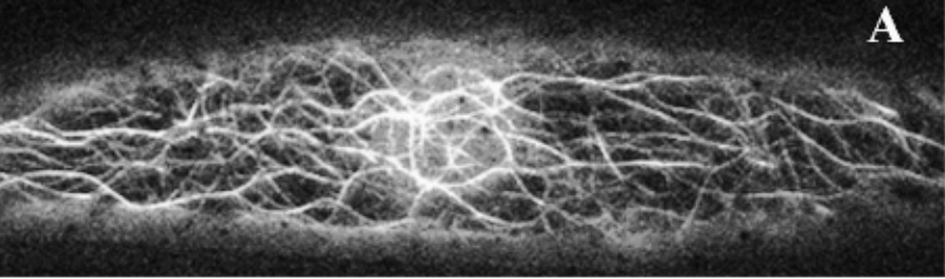 When the plant-compatible GFP came along in 1996/7, the microtubules were of course among the first structures to be imaged, this time using the Microtubule Binding Domain (MBD)-protein. [4]
