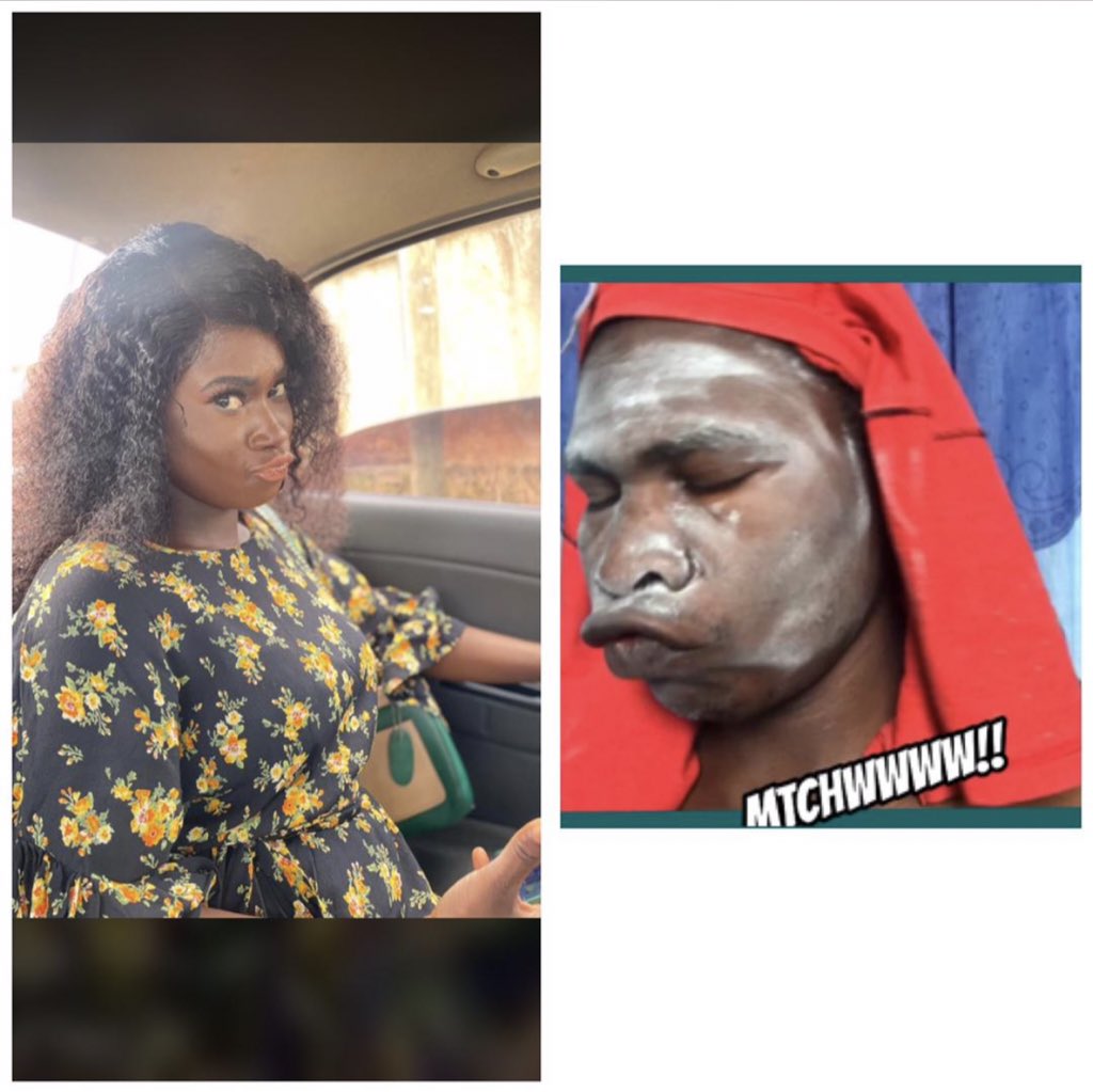 NanaFbi's tweet photo. Wen powder replaces Mary Kay
#Afterbathing
@malcolm_kyei @Osei_Feliciaa @Ziongee @NanaAfiaHemaa @king_steffen @kooSebor @nydjlive @Papjay007 @thenanaaba @MrKatah @gyaigyimii @abnradioone @Tytus360 @djsliming https://t.co/oQGbSUw1FS