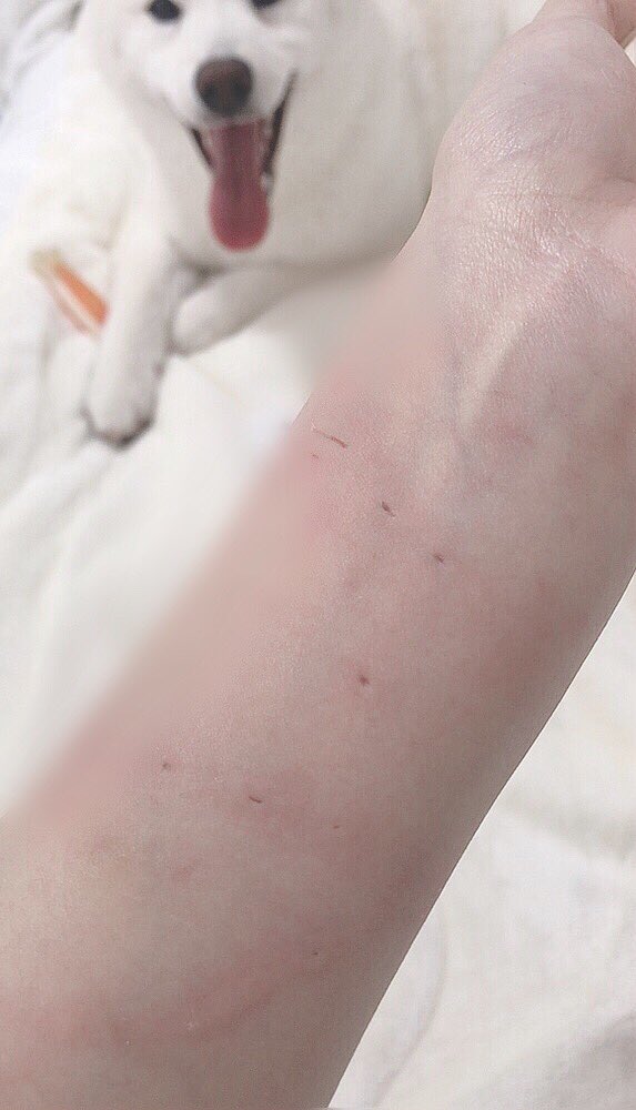 白柴もち吉 ちょっと傷注意 物を取られる と思って怒ってきたん初めてやし 本気噛みされたんも初めて ʚ 噛まれた瞬間めっちゃでかい声で 怒ったからびっくりして目まんま るにしてた ʚ 痛かったぁ ʚ 柴犬 白柴 犬のいる暮らし 犬好き 白柴もち吉 ちょっと傷注意 物を取られる と思って怒ってきたん初めてやし 本気噛みされたんも初めて ʚ 噛まれた瞬間めっちゃでかい声で 怒ったからびっくりして目まんま るにしてた ʚ 痛かったぁ ʚ 柴犬 白柴 犬のいる暮らし 犬好き