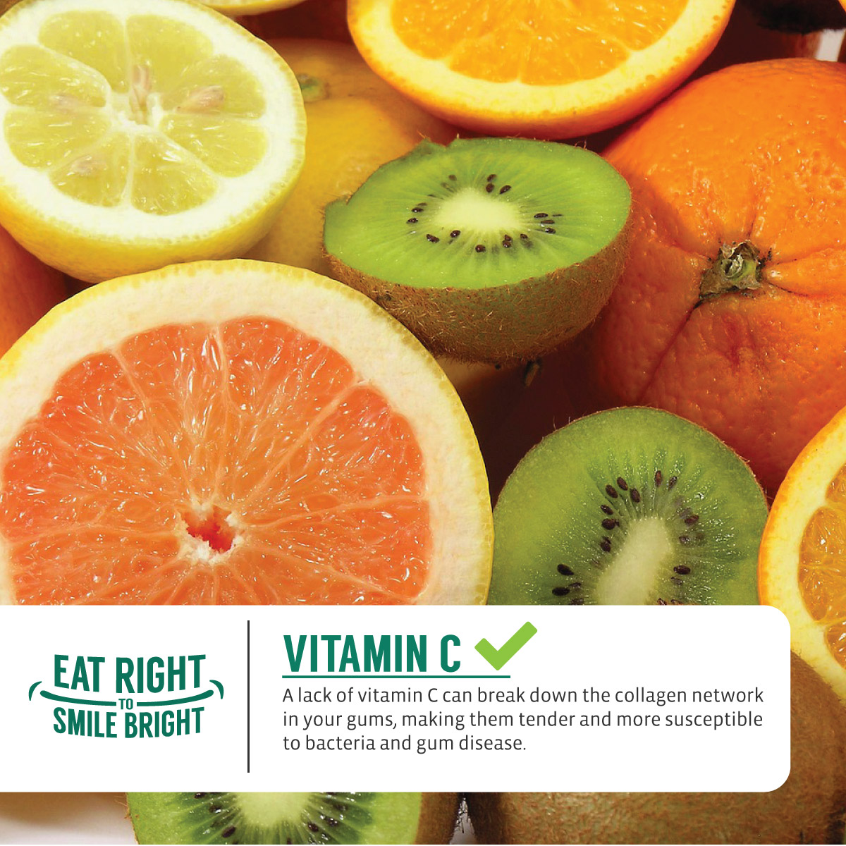 VITAMIN C IS WHAT makes your gums strong and durable! Without enough of it, your gums can become more prone to infection and disease.