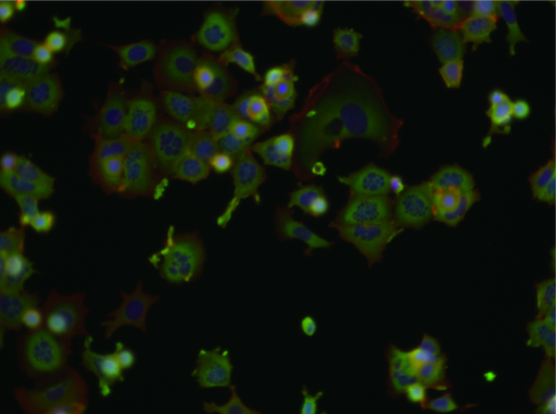 One common method is to treat cell cultures and use microscopy to detect and analyze every single cell, measuring the effect of the candidate molecules.However, tens of thousands of images (like below) are not simple to analyze.(Image source:  https://bbbc.broadinstitute.org/BBBC021 )