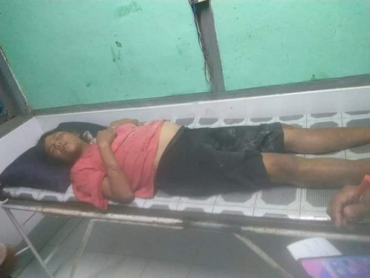 zackzackll's tweet photo. Tw \\ blood
A family was injured due to a bomb exploded in a garbage bag near a police station in #Myeik College while they were picking up trash.
-Father was severely injured.
#Apr26Coup
#WhatsHappeningInMyanmar https://t.co/qU9aFlHBQd