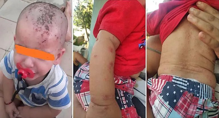 bayardo_el's tweet photo. Realmente  tu miedo está por encima de tu sangre? ,de tus hijos y nietos ? Ningún niño pide venir al mundo, entonces que vas a hacer para protegerlo ?,hasta cuando el cubano será perro por miedo? , dejarán que sus hijos mueran podridos de sarna ? 
#SalALaCalleYDiBasta!
#Levantate https://t.co/MNcmGyHOea