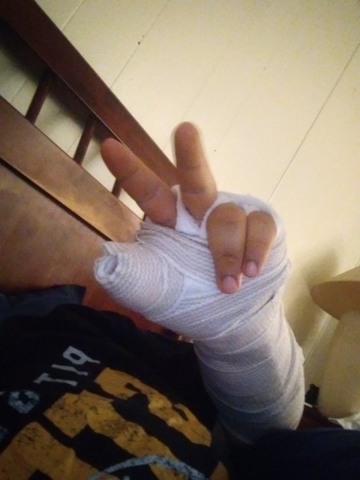 New uc ligament who dis? https://t.co/e7hAjHFDss<a href="/tag/vaccinated"class="tags"><span>#vaccinated</span></a>