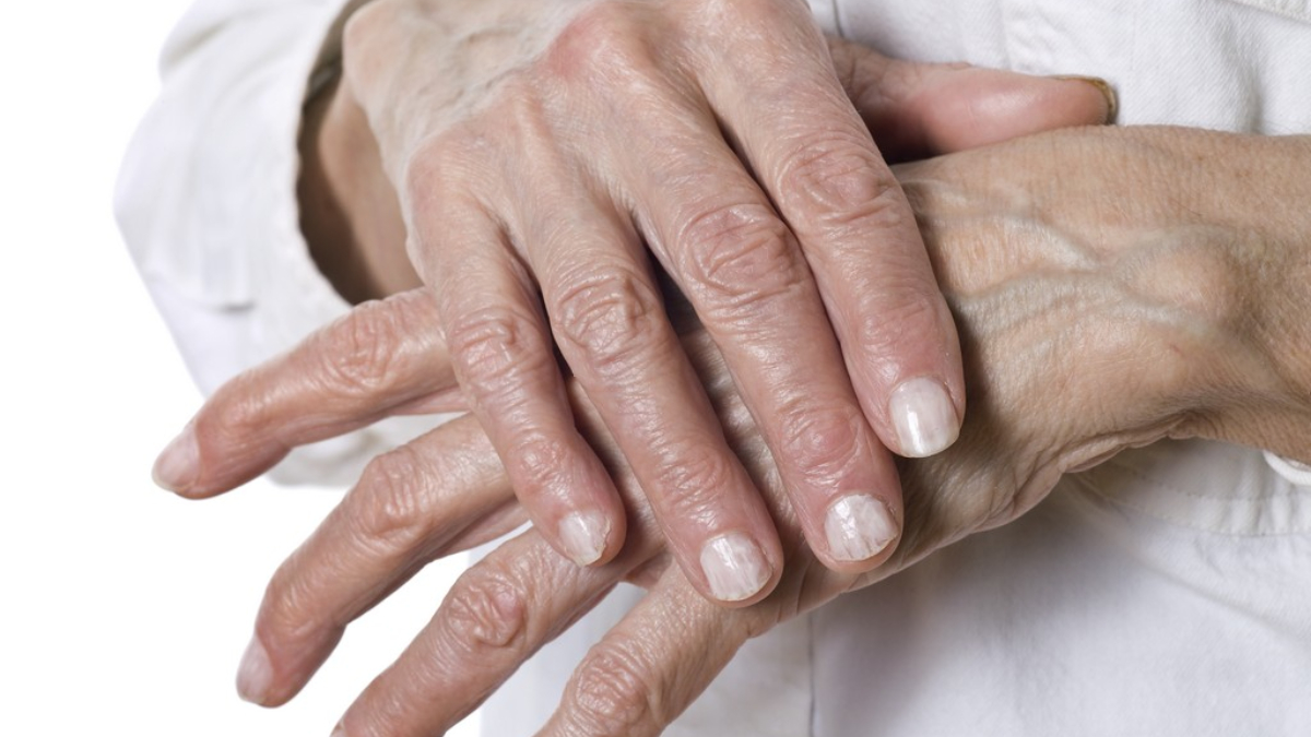 onetoonehc's tweet image. What Parts of the Body Deteriorate Faster with Age?

1. Hair
2. Elbows
3. Chest
4. Hands
5. Eyelids

#BodyParts #OneToOneHomeCareLLC