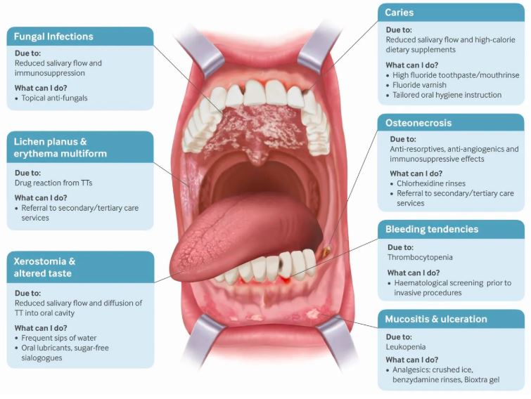Thoughtful Tuesday👥 Oral health needs to become integrated into every individual care plan. Oral health issues can often be overlooked, the implications of medication and diet. It is important to minimise harm and use effective prevention strategies. @MCM_HEKSS @DCHStrust