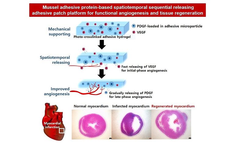 Cn1699's tweet image. Heart Patch Helps Grow New Vessels Post Myocardial Infarct

#heartpatch #myocardialinfarct 

For more information | ⬇️
buff.ly/32e4mdx