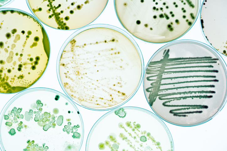 RdeAustry's tweet photo. Five-year EU research project identifies marine microbe promise for petrochemical replacement https://t.co/nhuxxtV8NW https://t.co/kyhmTWhr3e