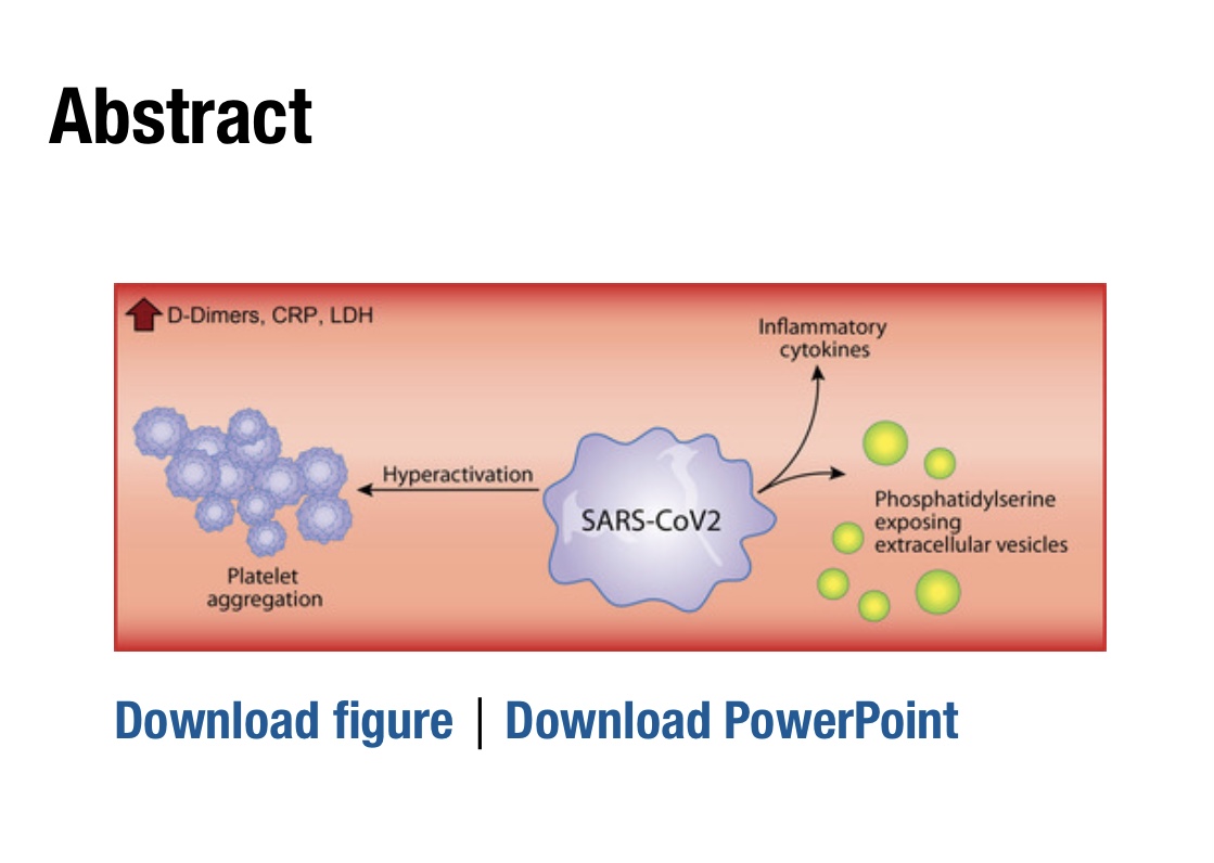 6/x Platelets Can Associate With SARS-CoV-2 RNA and Are Hyperactivated in COVID-19 https://www.ahajournals.org/doi/abs/10.1161/CIRCRESAHA.120.317703