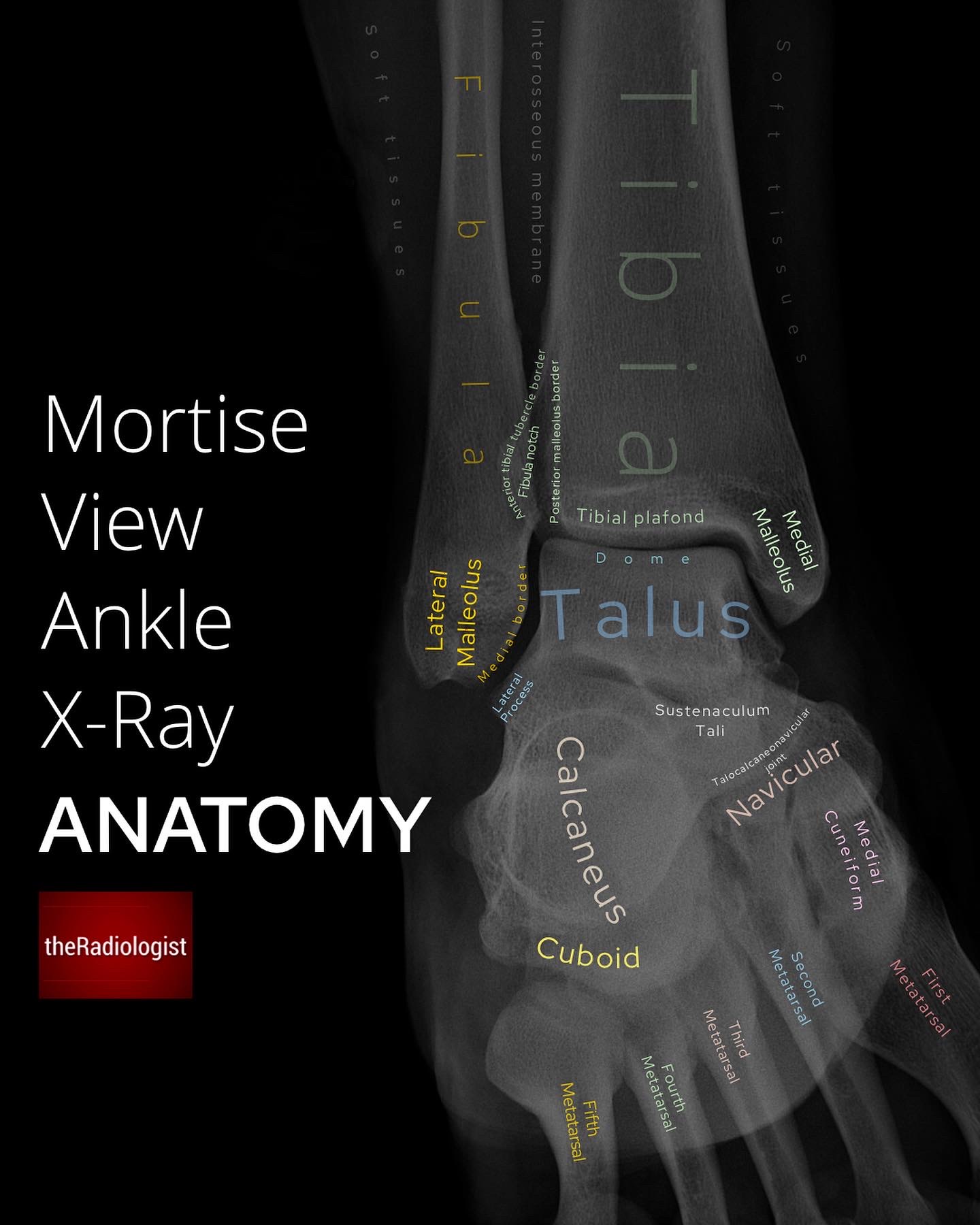 Radiographic Anatomy Of The Skeleton Ankle Mortise Vi vrogue.co