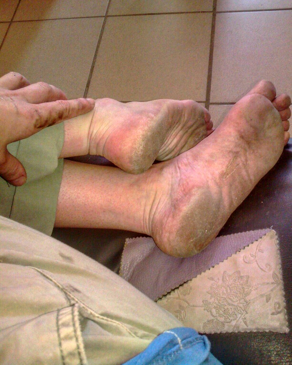 DemianaOlga's tweet photo. Uuuh... soo good... i do t understand people who dont like their fet like this.  Soo natural  so beatiful
https://t.co/oe1zTetfeh
#prettyfeet l #foot # #footfetishmodel #footfetish👣 #solesfetish #solesfeet #dirtyfeet #dirtyfeetarehappyfeet #dirtyfeetgirls #dirtyfeets #Commission https://t.co/2UBjEpVikX