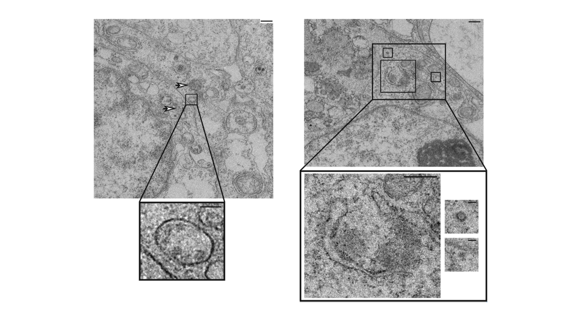 Organoid News (@organoidscience) on Twitter photo Aditya Mithal (<a href="/aditya_mithal/">Aditya Mithal</a>), Adam Hume (<a href="/AdamJHume/">Adam Hume, PhD π¦π¬π§¬β£οΈ</a>) & researchers from the <a href="/GMostoslavsky/">Gustavo Mostoslavsky</a> lab report that #SARS-CoV-2 productively infected both proximally and distally patterned human iPSC-derived intestinal #organoids.
π <a href="/stemcellreports/">StemCellReports</a>: bit.ly/2Q3yKEX Aditya Mithal (<a href="/aditya_mithal/">Aditya Mithal</a>), Adam Hume (<a href="/AdamJHume/">Adam Hume, PhD π¦π¬π§¬β£οΈ</a>) & researchers from the <a href="/GMostoslavsky/">Gustavo Mostoslavsky</a> lab report that #SARS-CoV-2 productively infected both proximally and distally patterned human iPSC-derived intestinal #organoids.
π <a href="/stemcellreports/">StemCellReports</a>: bit.ly/2Q3yKEX