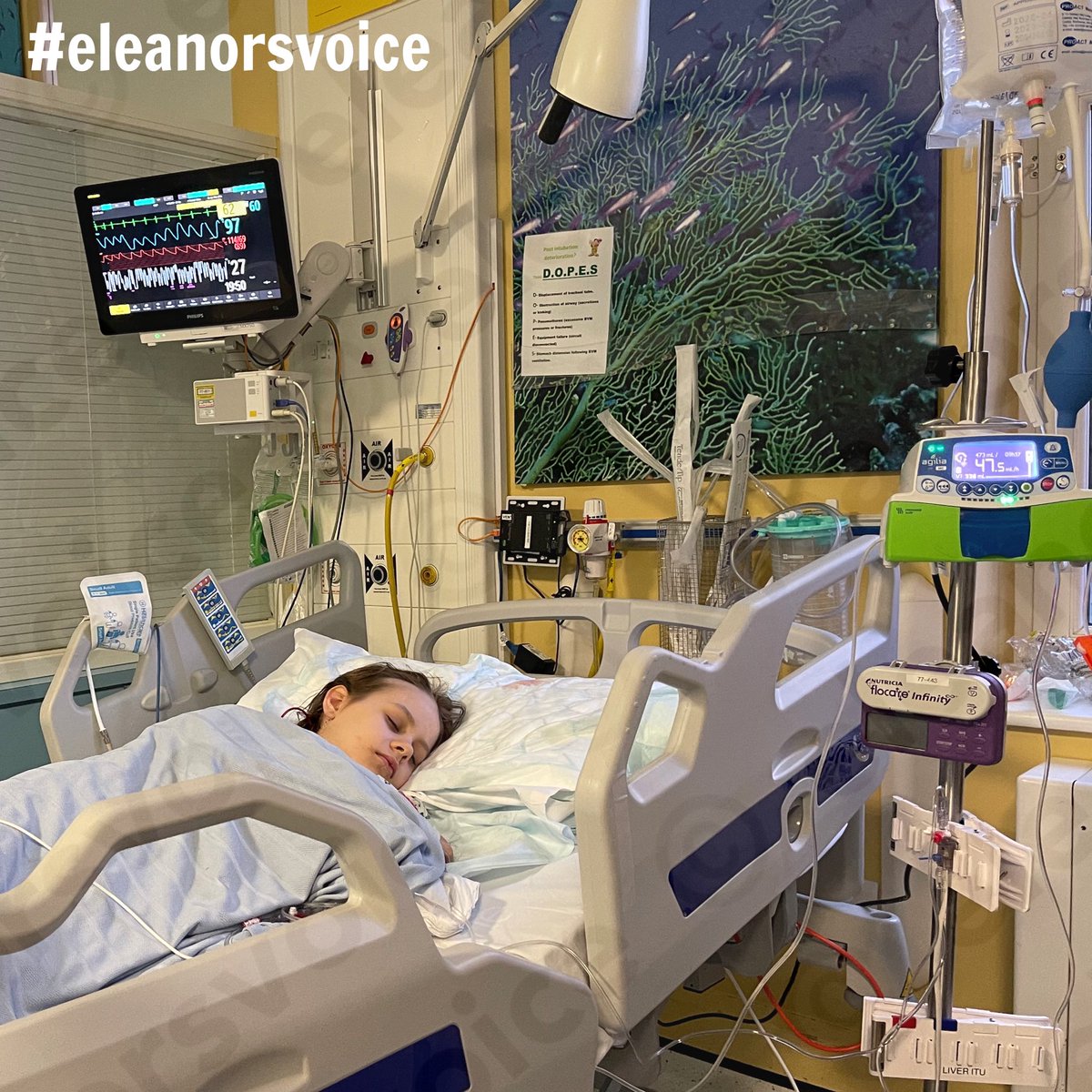 After 7 long hours of complex neurosurgery, Eleanor is back! All went well. She’s still very groggy and we aren’t out of the woods quite yet. We are incredibly grateful for all your msgs of support. Please keep sending positive vibes, whatever your beliefs! #eleanorsvoice 🤕💜✨