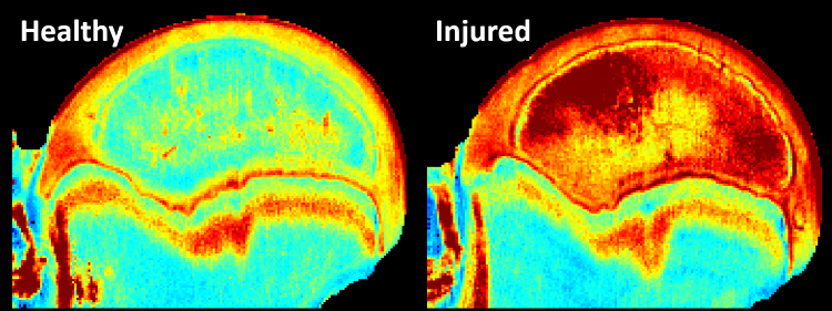 umnCVMresearch's tweet photo. Could a different approach to an MRI help identify Legg-Calvé-Perthes disease in children &amp; improve intervention strategies? Find out how @umnCVM researchers are tackling this challenge. https://t.co/Fb4VOFBcAJ  #Imaging #BoneHealth #VeterinaryMedicine #VeterinaryResearch https://t.co/kPjI5b6QmD