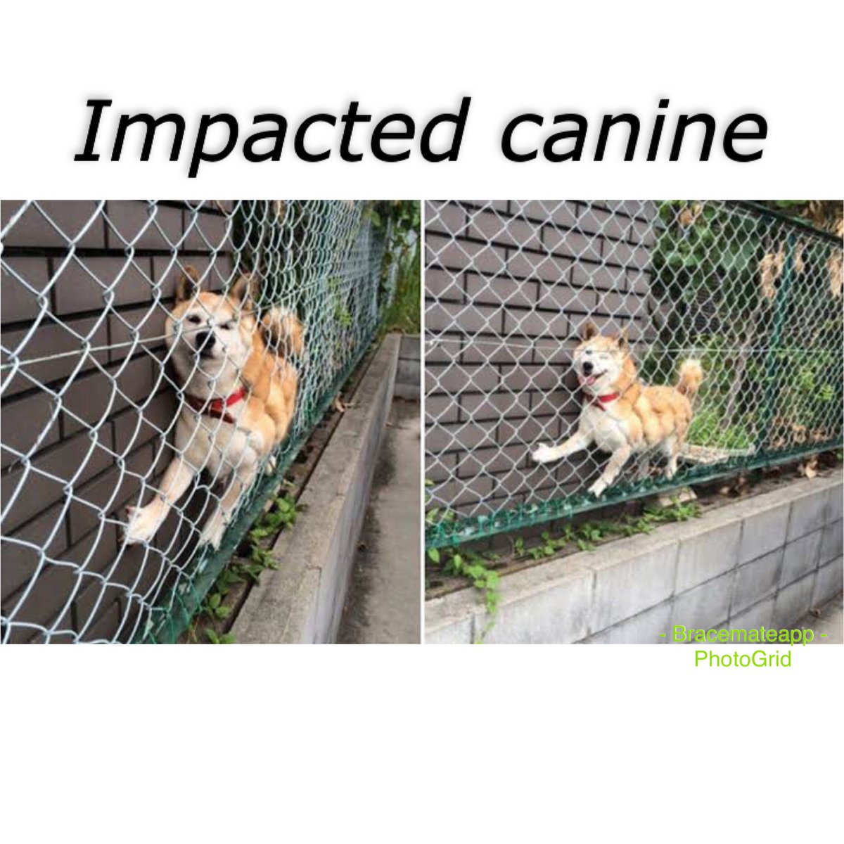 #Orthodontics #ortho #orto #ortodoncia #ortodoncista #ortodontia #ortodontista #frenos #aparelhoortodontico #aparelho #ortodontico #brackets #braces #odontologia #odontología #dentistry