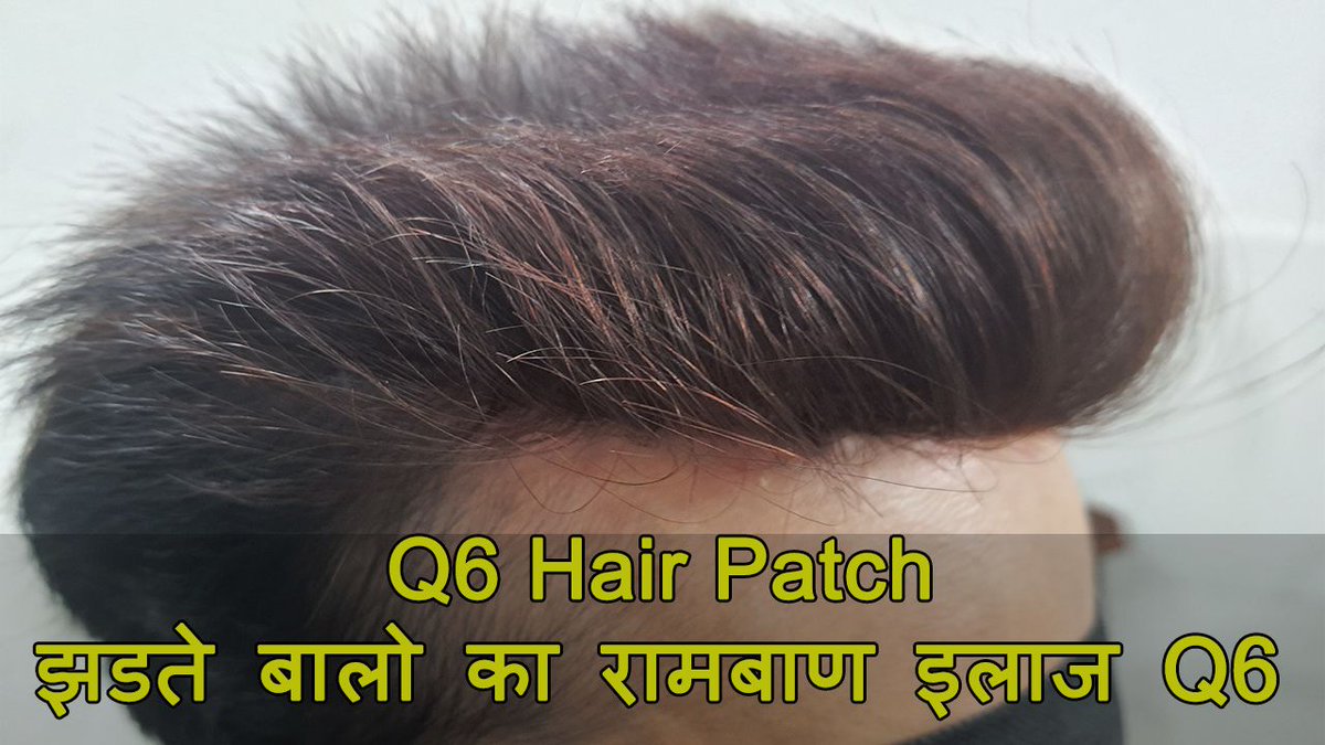 Amit Chaudhary (@delhihairphc) / Twitter Amit Chaudhary (@delhihairphc) / Twitter
