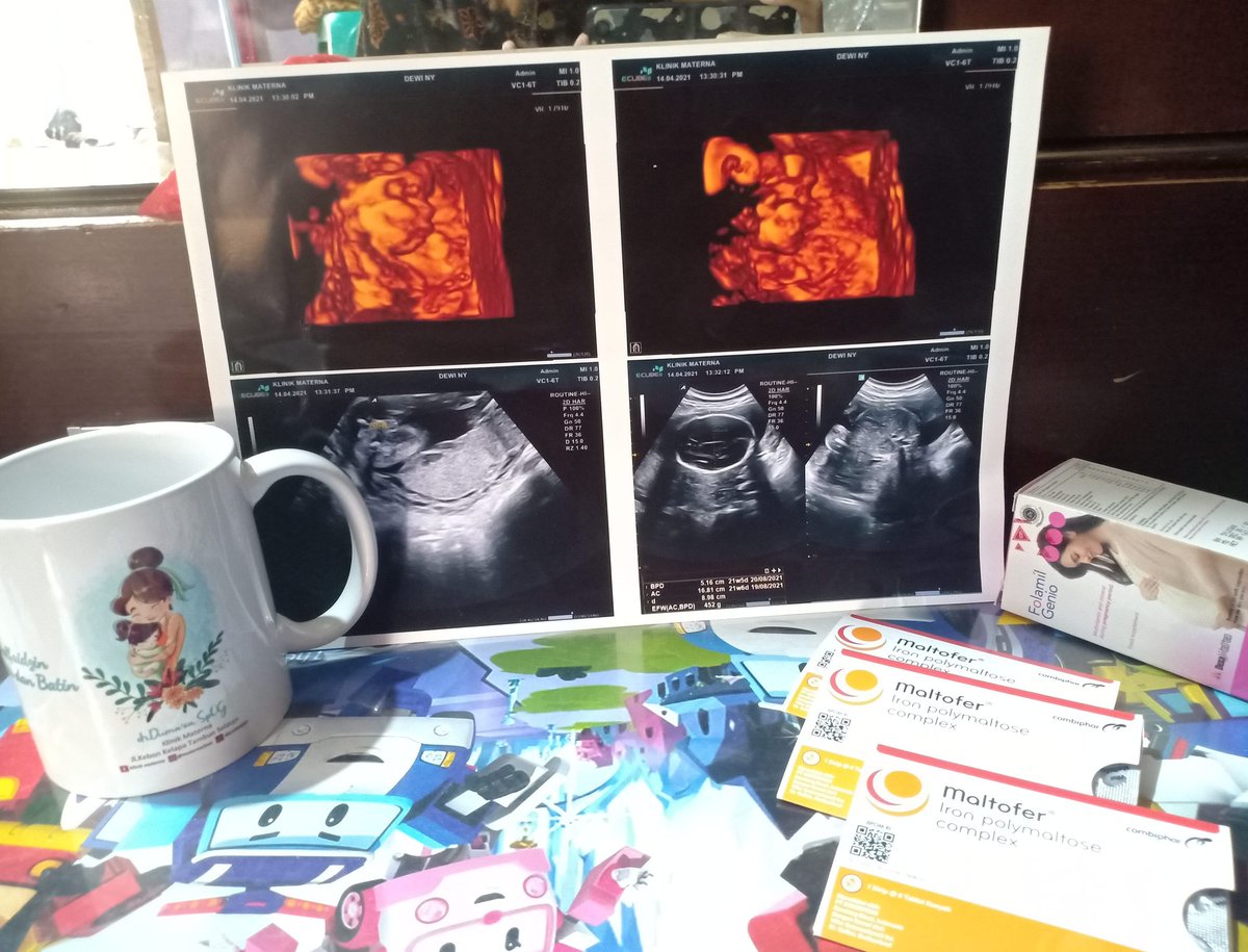 ibukanak3's tweet photo. Sehat selalu adek #21week https://t.co/c4pXkzEavC
