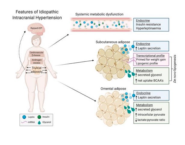 #IIH have insulin and leptin resistance demonstrated, along with unique changes in adipocytes. @IIHDrBirmingham <a href="/ConnarWestgate/">Connar Westgate</a> @IMSR_UoB insight.jci.org/articles/view/…