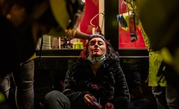 La joven que perdió un ojo en la protesta por Hasel se querella contra el mosso que le disparó naiz.eus/eu/info/notici…