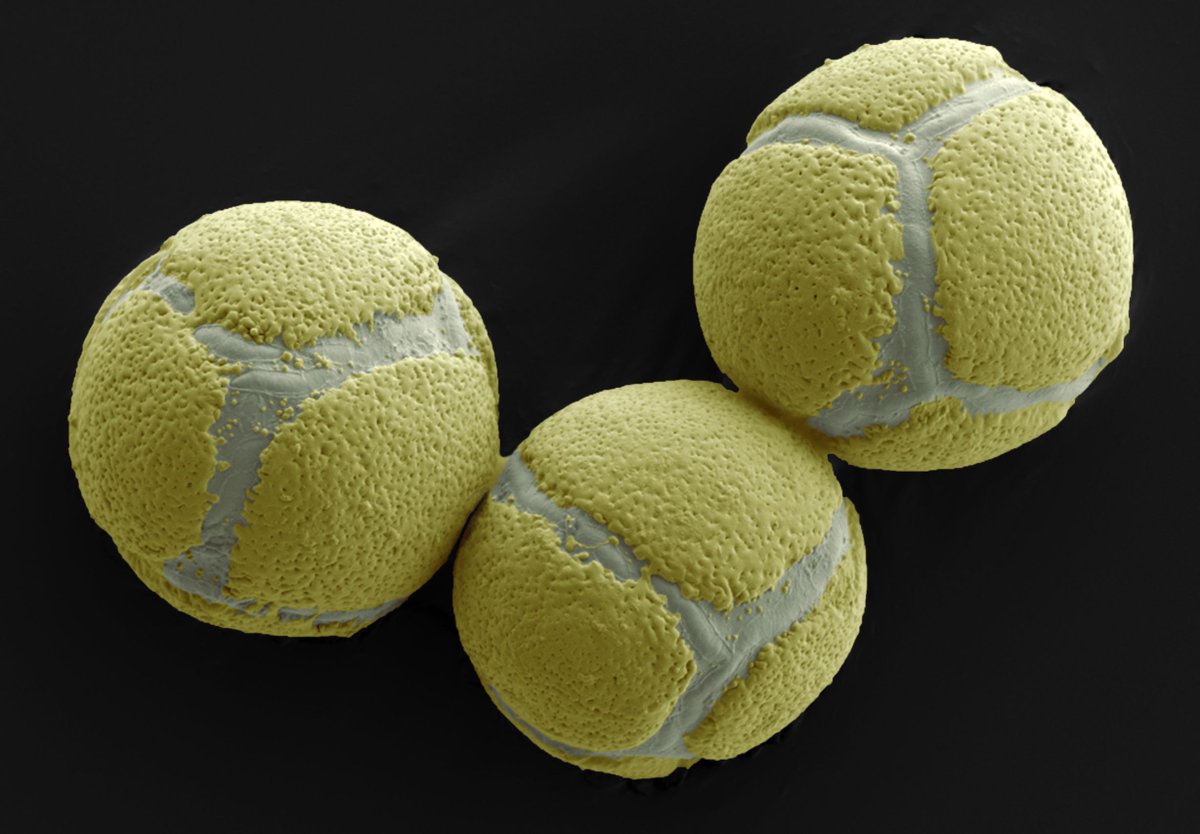 Norwich Research Park Image Library (@norwichsciimage) on Twitter photo Tennis balls? -Think again! SEM allows us to see into the microscopic world and view things like this; the pollen of wild mahonia flowers. These have been false coloured by Kim Findlay in the bioimaging department of <a href="/JohnInnesCentre/">John Innes Centre</a>
For more images - okt.to/Yfs5Uh Tennis balls? -Think again! SEM allows us to see into the microscopic world and view things like this; the pollen of wild mahonia flowers. These have been false coloured by Kim Findlay in the bioimaging department of <a href="/JohnInnesCentre/">John Innes Centre</a>
For more images - okt.to/Yfs5Uh