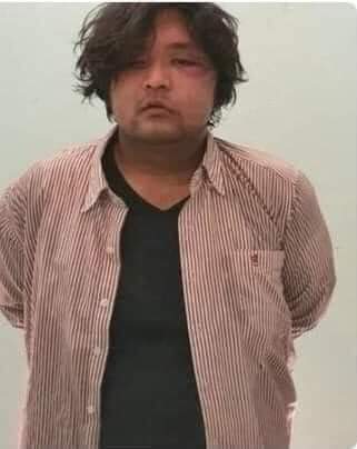 This is a picture of Wai Moe Naing who was brutally beaten by military 
As  he belongs Muslim minority, his life great danger 
Please Speak Out for Ko Wai Moe Naing .
Please pray for him your respective religions.

#RejectMilitaryCoup
#WhatsHappeningInMyanmar