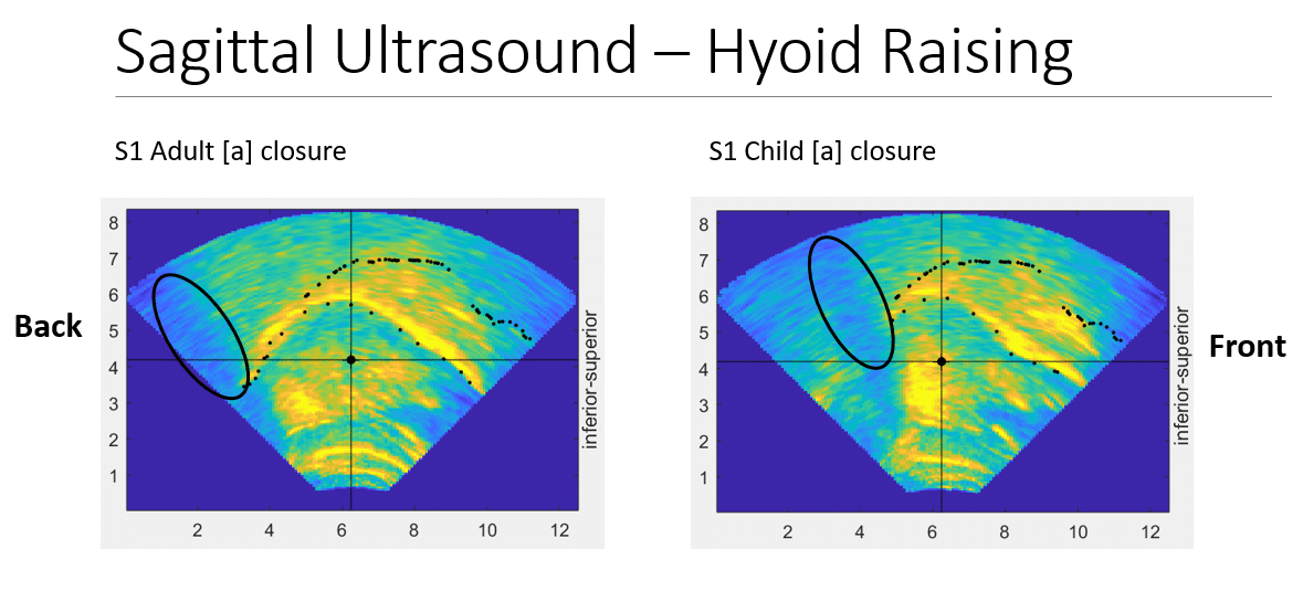 acousticsorg's tweet photo. Happy #WorldVoiceDay! Learn about the Science of Voice Acting in this paper presented at the 179th ASA meeting: https://t.co/un0Pi54Y1j
@IUBloomington https://t.co/plnOo2o6HT