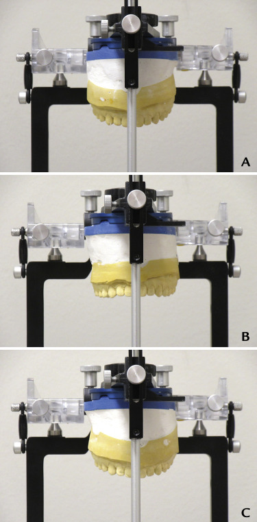 JPDentistry's tweet image. A #facebow orients the #maxillary cast to the #articulator to mimic the #maxilla to the cranial base. Different mounting techniques &amp;amp; instruments can lead to different orientations which may impact #occlusion. Learn more: thejpd.org/article/S0022-…