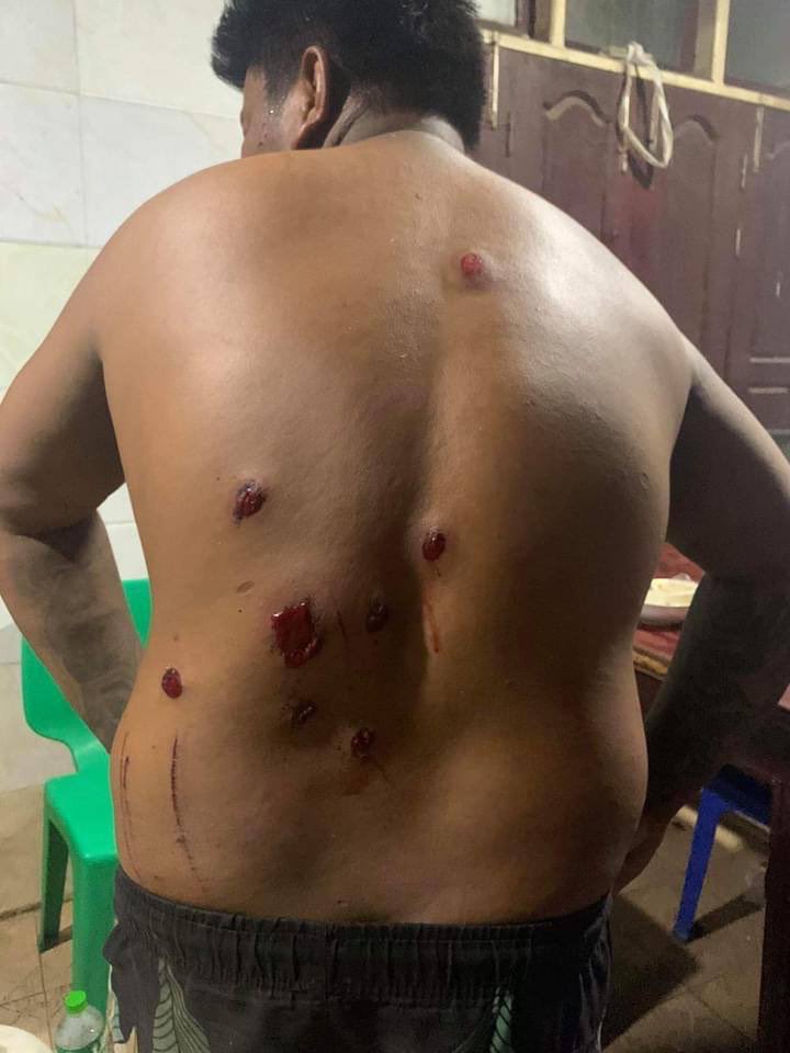 ThadaSu27's tweet photo. tw // blood
HtayAungKyaw from BEHS (13) Mandalay was abducted unlawfully by Junta and released today with full of rubber bullets wounds on his back.
SILENT REVOLUTION
#Apr16SilentStrike
#WhatsHappeningInMyanmar https://t.co/HR04PXgZAN