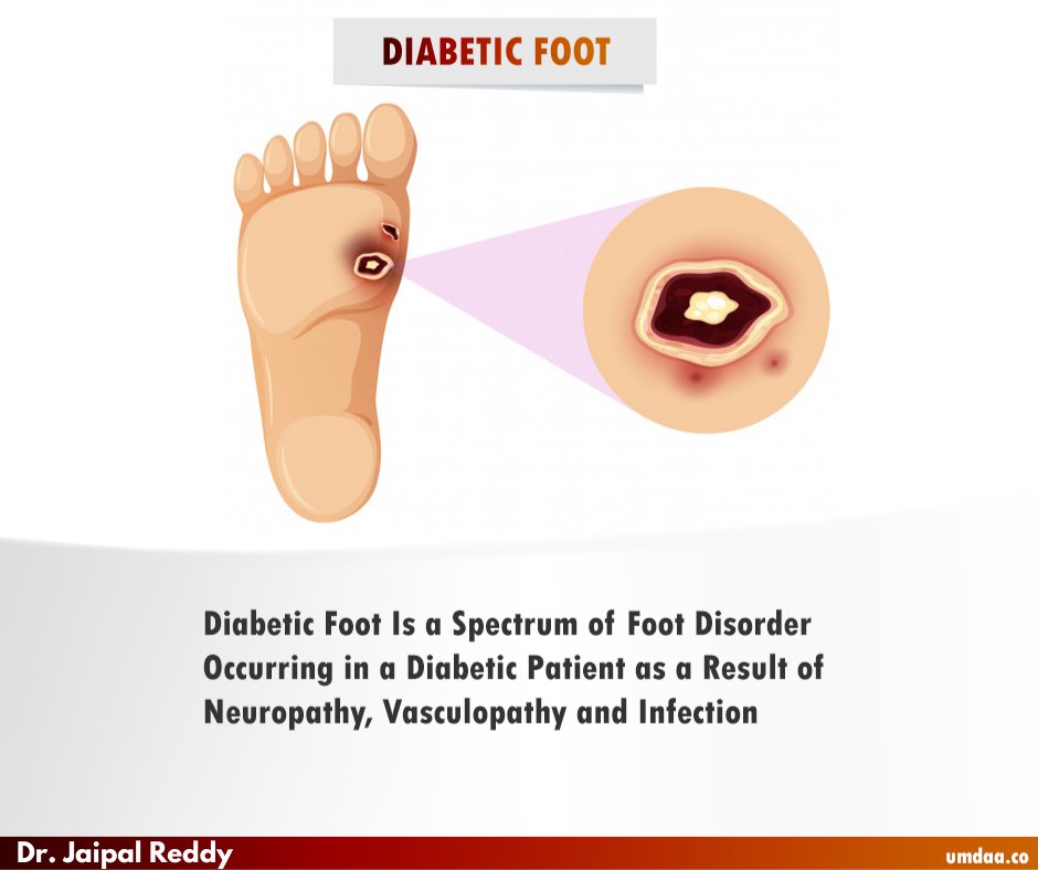 #Drjaipalreddy is a #Diabetologist  
#diabetes #diabetescauses #bloodsugar #kidneydamage #highbloodpressure #uncontrolleddiabetes #diabeticneuropathy #diabeticfoot #highbloodsugarlevels