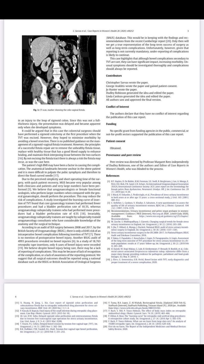 Case report of woman with #mesh cutting her bowel which claims its a rare complication 'in the literature' but thats only as nobody has written about it. Doesnt mean it isnt happening. 1/3 of our group had mesh slice organs or thru vaginal walls #casualty