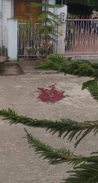 aungkohtoo24's tweet photo. #Tw// Blood

Crackdown by Junta has been intense in Mogok. 

2 civilians have passed away and their dead bodies were confiscated 
The other one was shot at the head
Junta killing people at the start of Myanmar year #Apr17Coup #WhatsHappeningInMyanmar https://t.co/WelriCklYj
