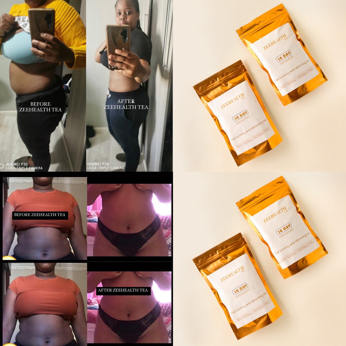 zeehealth waist trainer
