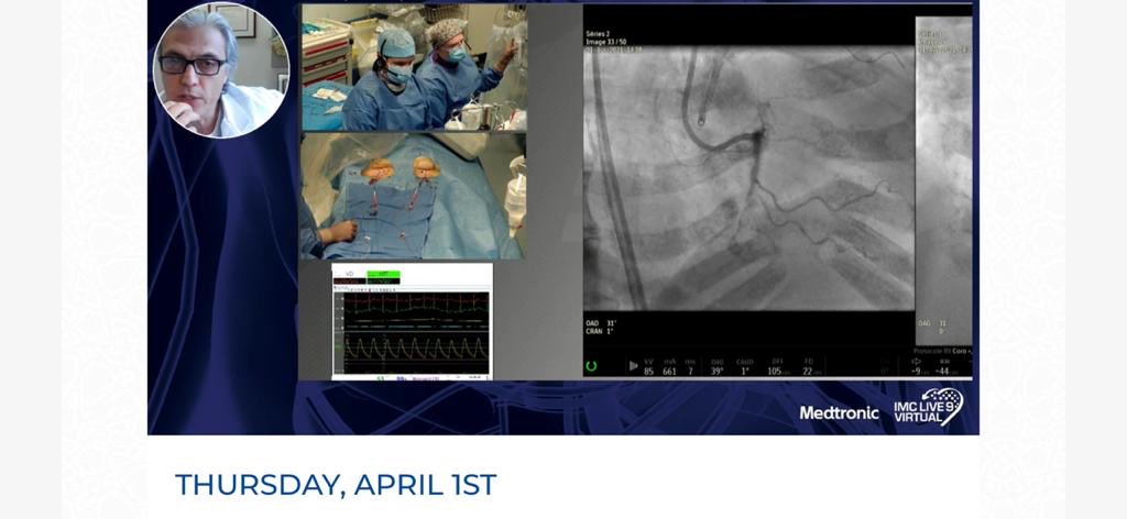 AAvran CTO roadtrip man (@avranctotrip) on Twitter photo 2 live cases in 15 days IMC from Jeddah and Turino CTO this week with a complex double cto case 2 live cases in 15 days IMC from Jeddah and Turino CTO this week with a complex double cto case