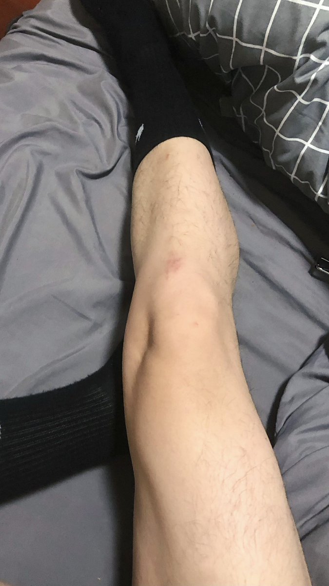 只有腿才称得上非常粗大…