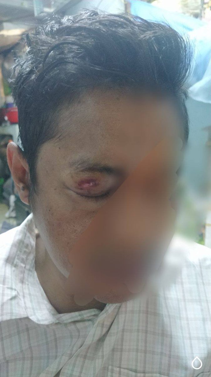 Nan_Mon01's tweet photo. Military terrorists beat brutally to the civilian.His back was trampled and his face was swollen. 
NUG ASSEMBLE 
#WhatsHappeningInMyanmar 
#Apr17Coup 
#CrimeAganistHumanity https://t.co/Qe44yIlMnv https://t.co/8ARPFRePIZ