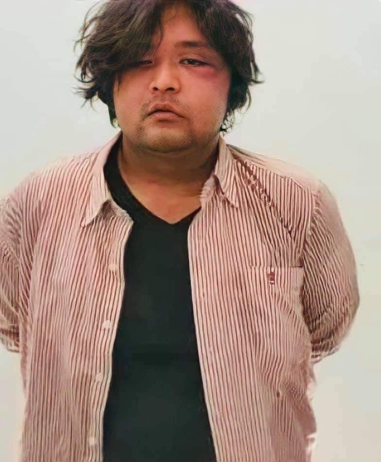 Dara (@daraxwt) on Twitter photo Ko Wai Moe Naing, Monywar protest activist was brutally tortured by Junta during the detainment. He was hit by a car and beaten at the time of arrest yesterday. <a href="/UN/">United Nations</a> <a href="/UNHumanRights/">UN Human Rights</a> <a href="/freya_cole/">Freya Cole</a> #WhatsHappeningInMyanmar #CrimeAgainstHumanity #ReleaseTheDetainees Ko Wai Moe Naing, Monywar protest activist was brutally tortured by Junta during the detainment. He was hit by a car and beaten at the time of arrest yesterday. <a href="/UN/">United Nations</a> <a href="/UNHumanRights/">UN Human Rights</a> <a href="/freya_cole/">Freya Cole</a> #WhatsHappeningInMyanmar #CrimeAgainstHumanity #ReleaseTheDetainees