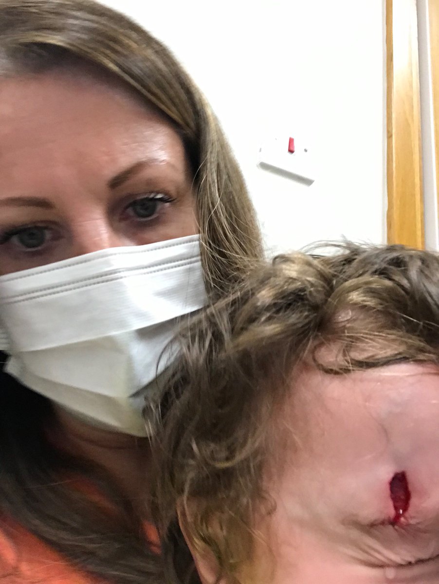 NicolaHutton's tweet photo. @GranadaReports I need your help. My 2 year old son has been refused treatment and 2 Manchester hospitals and has been sent home twice. He has an open head wound https://t.co/Sv8mQFNHMR