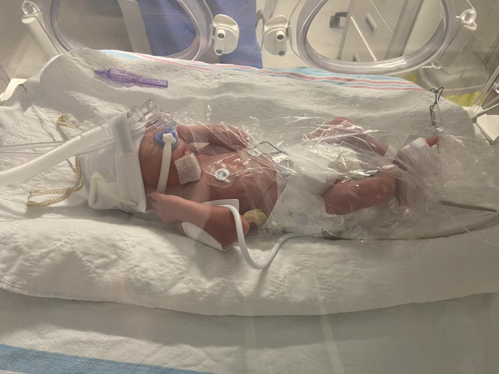 Everyone, meet Remy and River.

My wife’s doing good, they’re monitoring her closely for bleeding and to see if her preeclampsia symptoms worsen.

The twins are being monitored in the NICU.

I know I’ve asked a lot lately, but any prayers would be appreciated for my family.