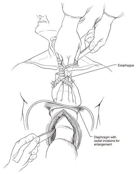 What if we held hands like this