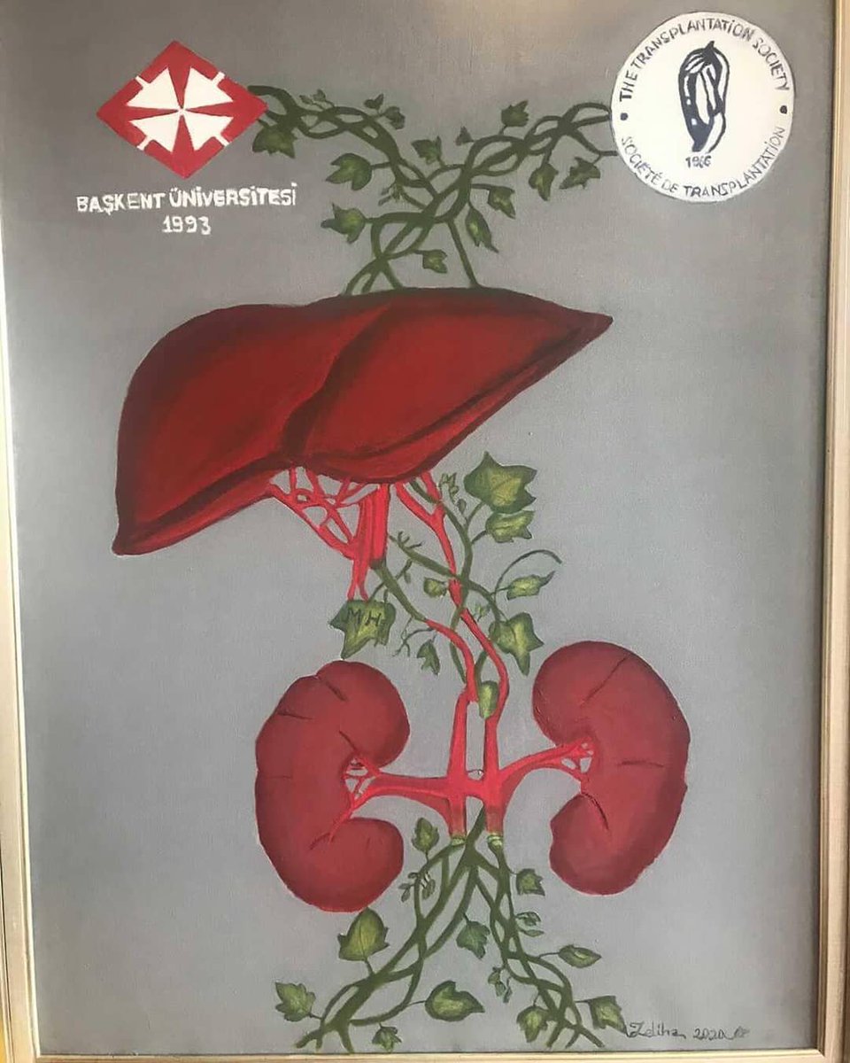 Kadir Demircan (@kdemircan1) on Twitter photo Organ nakli hayat kurtarır.
Karaciğer metabolizmanın beynidir.
<a href="/baskentunv/">Başkent Üniversitesi</a> <a href="/organnaklivakfi/">Türkiye Organ Nakli Vakfı</a>
#mehmethaberal
#nükhetdemirçekirdekatölye Organ nakli hayat kurtarır.
Karaciğer metabolizmanın beynidir.
<a href="/baskentunv/">Başkent Üniversitesi</a> <a href="/organnaklivakfi/">Türkiye Organ Nakli Vakfı</a>
#mehmethaberal
#nükhetdemirçekirdekatölye