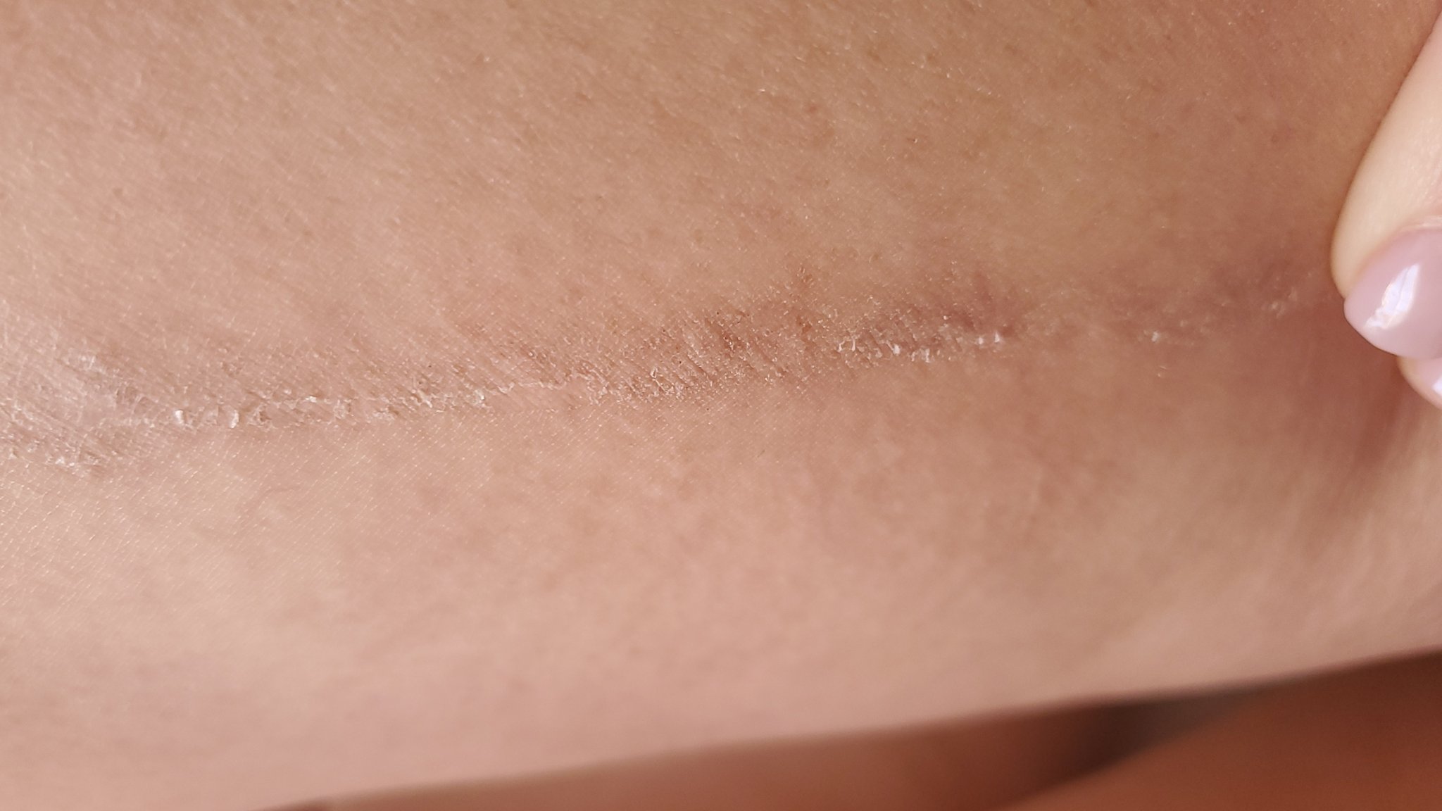 TW Pornstars - Alura Jenson Inc. Twitter. Scar tattoos are healing, albeit  not like a simple scratch. 3:26 PM - 18 Apr 2021